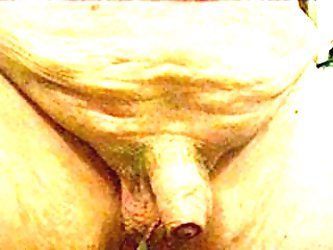 Foreskin Fun 1.0